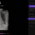 Imagen-radiografia